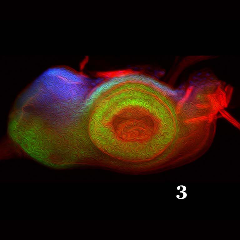 Light microscope image of a Drosophila eye-antennal disc. A disruption of the retinal determination network leads to the de-repression of non-retinal selector genes (green) and a homeotic transformation of the retina into head epidermis.